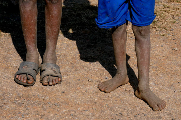 W wielu regionach na Madagaskarze buty to luksus